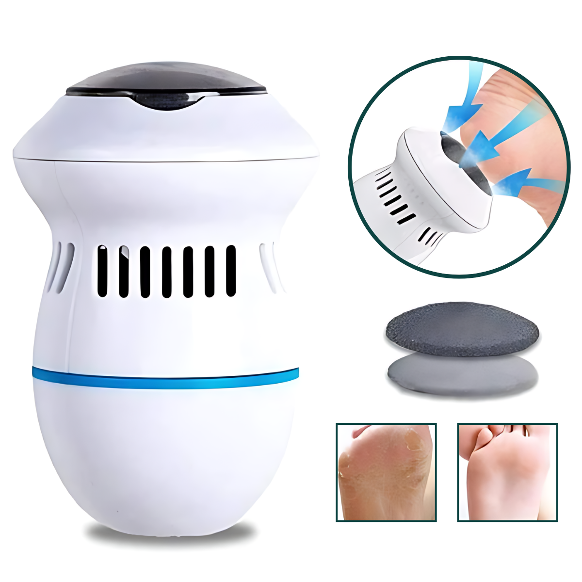 Removedor e Esfoliador Elétrico Para Pés