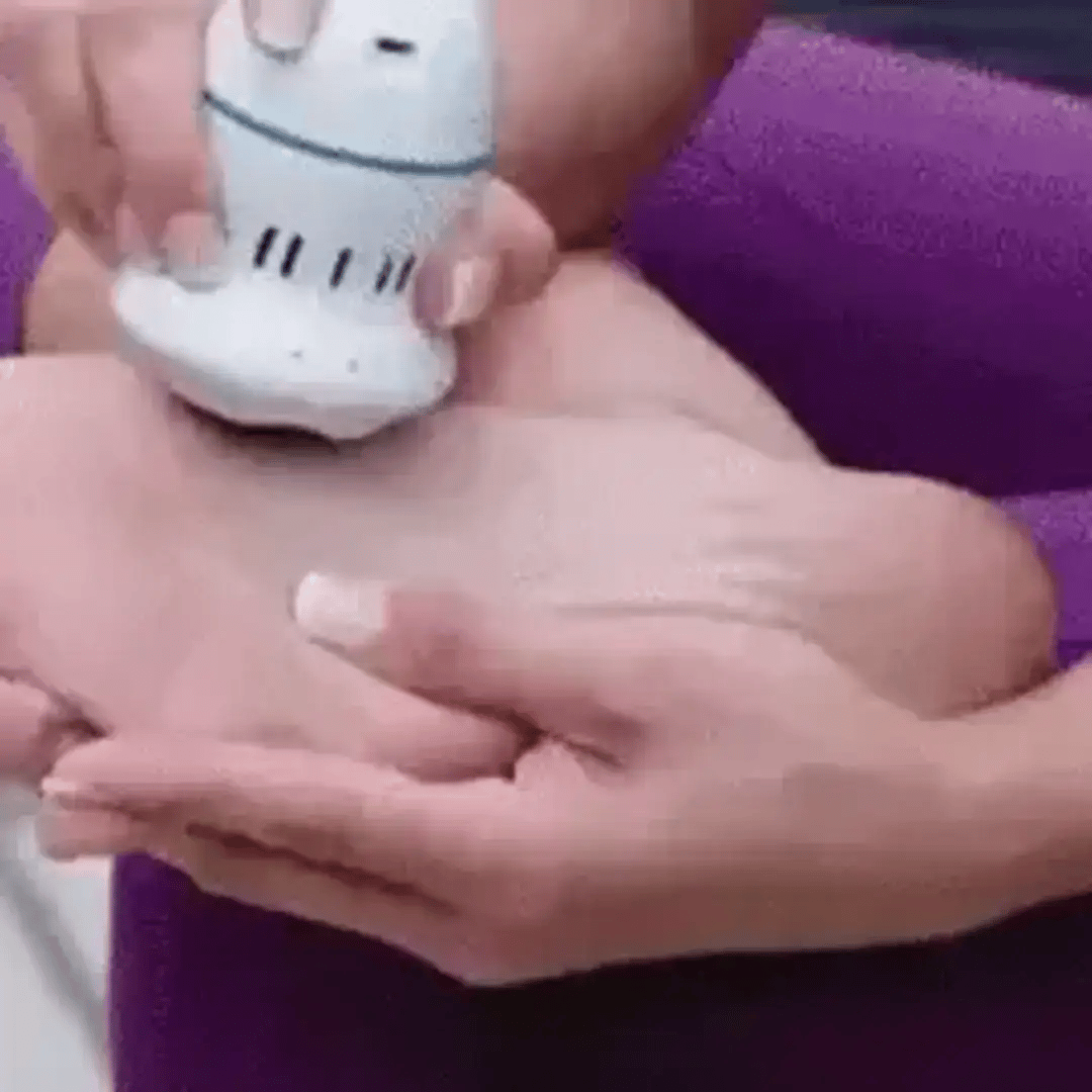 Removedor e Esfoliador Elétrico Para Pés