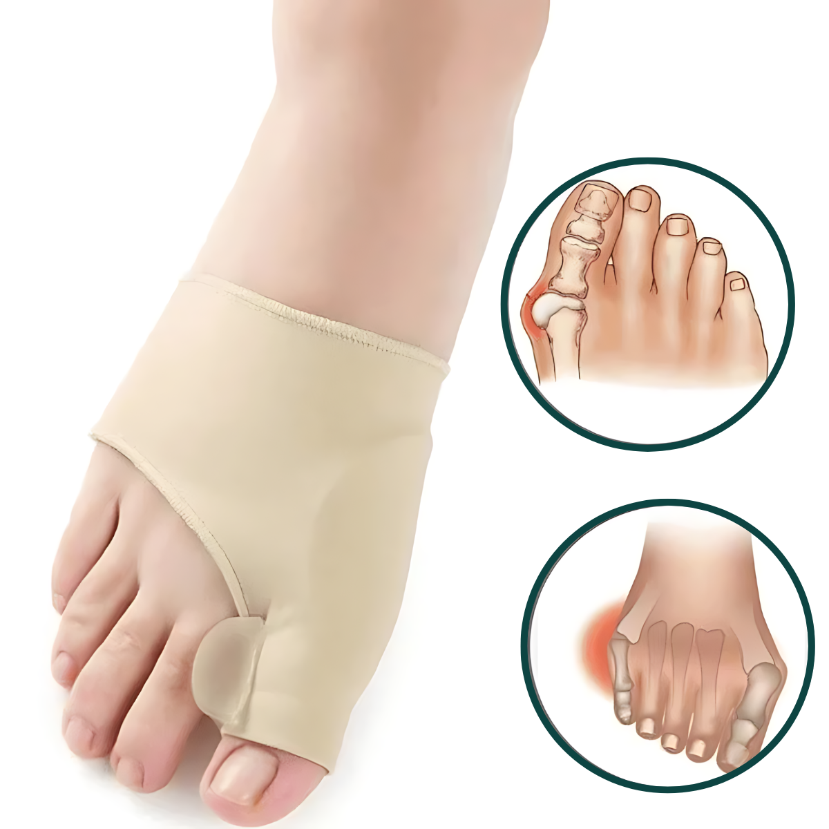 Meias Para Joanete - Alívio e Correção Foot Pads