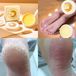 Kit Paceon de cuidados e hidratação intensiva com creme, raspador premium e meias de silicone