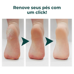 Lixa Elétrica Eliminadora de Calos