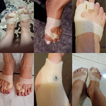 Suporte para joanete MagnetFlex com ímãs – alinhamento e alívio de dores nos pés